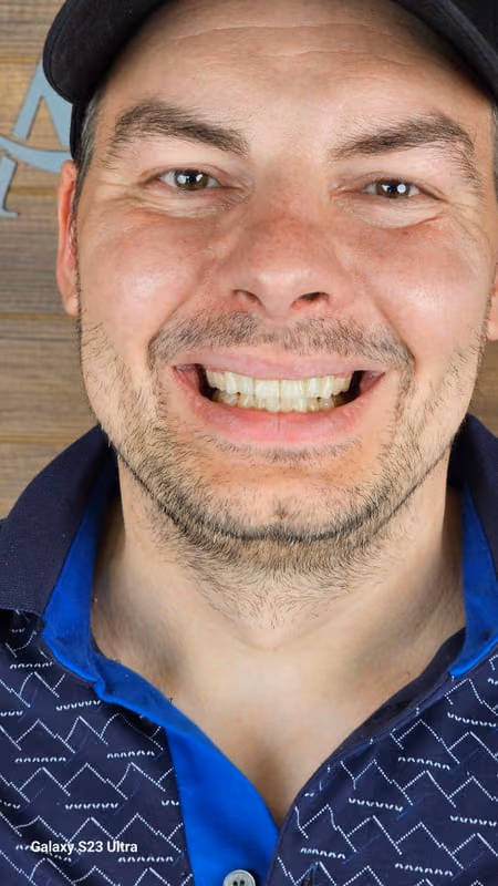 Patient smile result