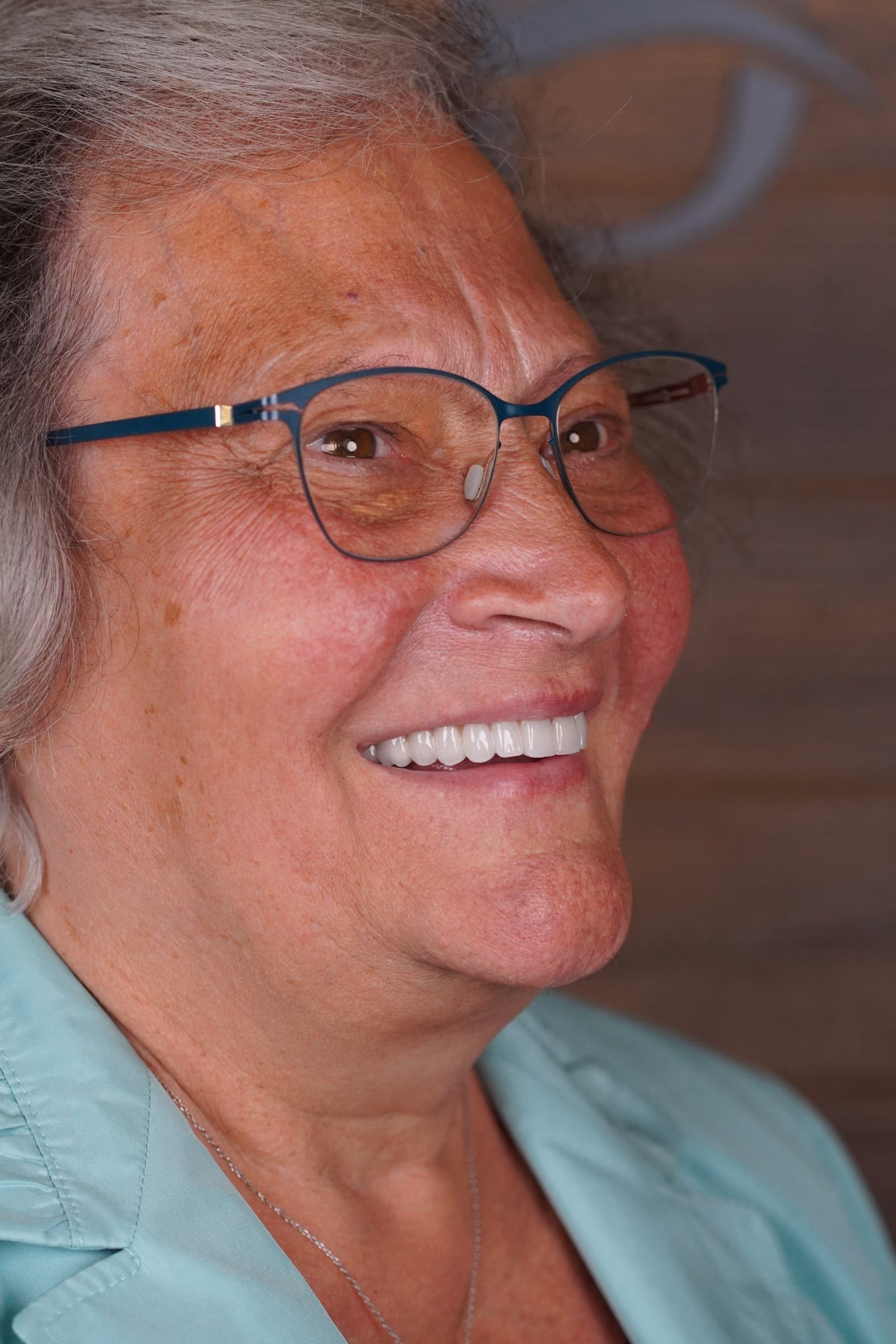 Patient smile result