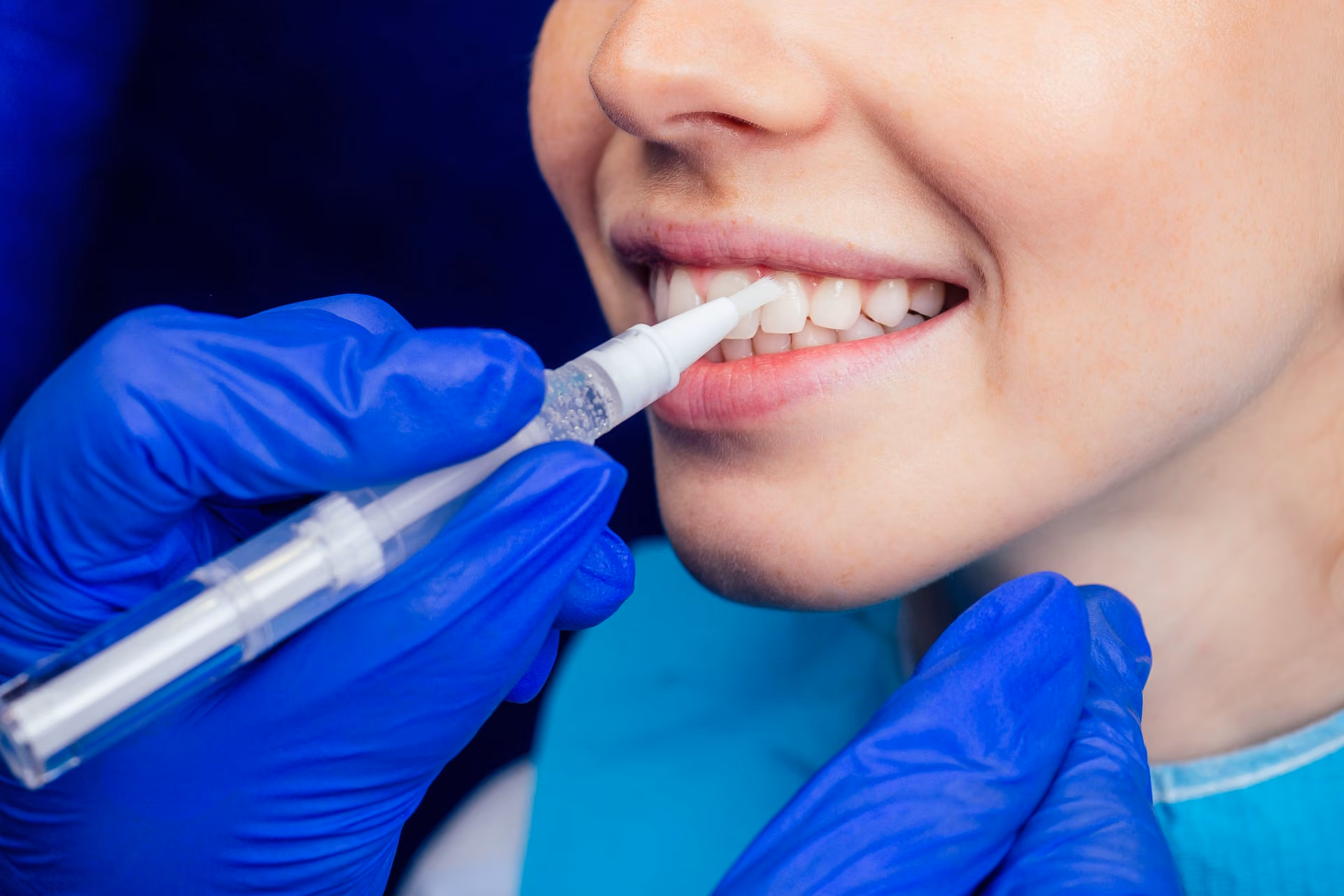 Teeth Whitening
