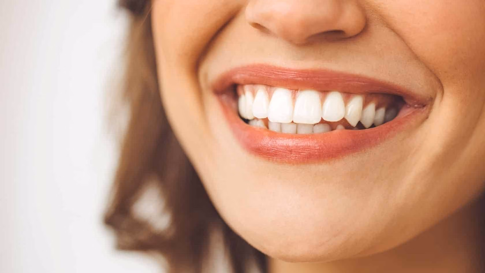 Smile Design