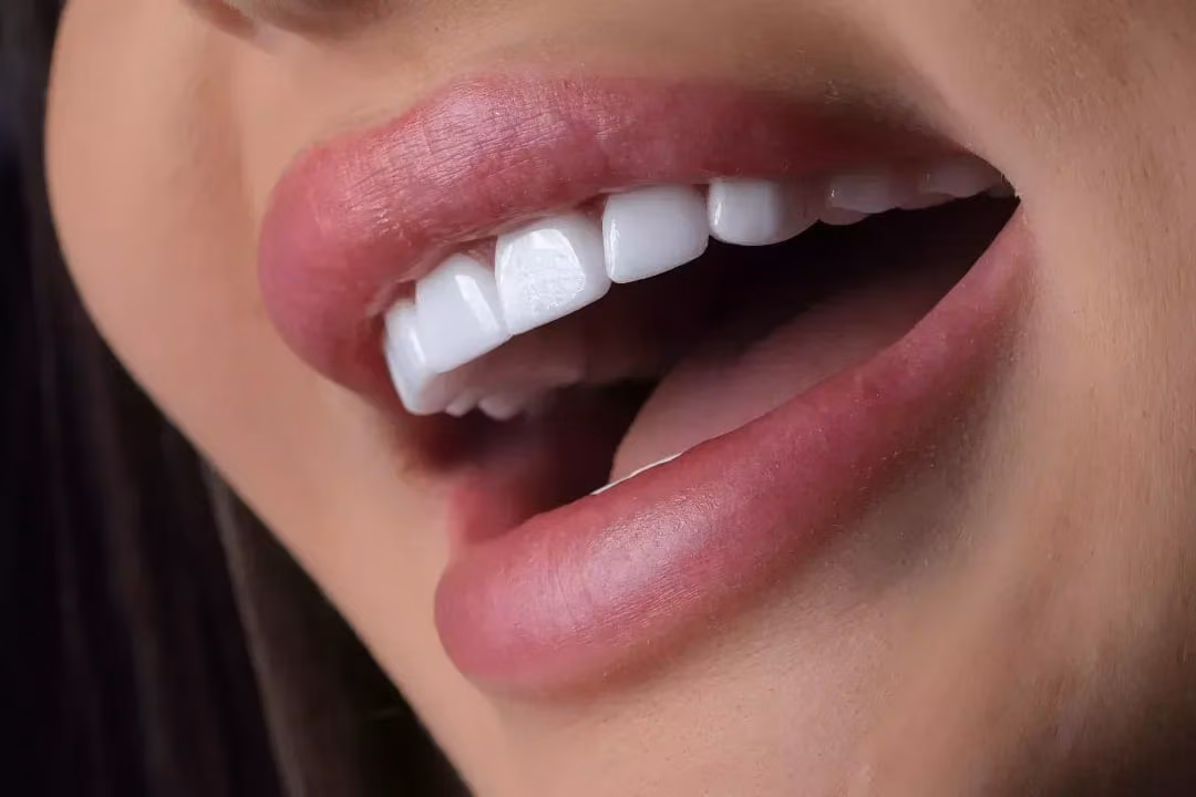 Hollywood Smile